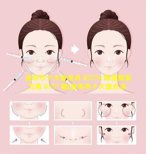 金华市十大激光点 🐼 痣医院实力揭 💮 晓(金华市十大激光点痣医院实力揭晓医生)